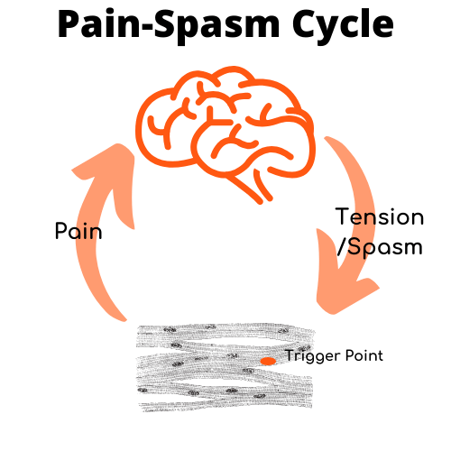 trigger-point-pain-spasm-cycle