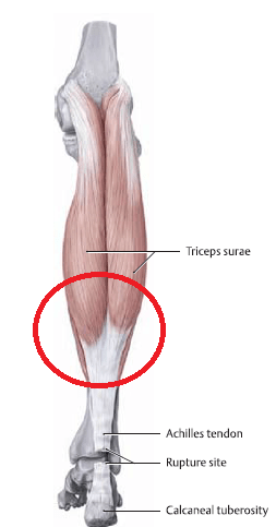 muscle tendenous junction of the calf muscles