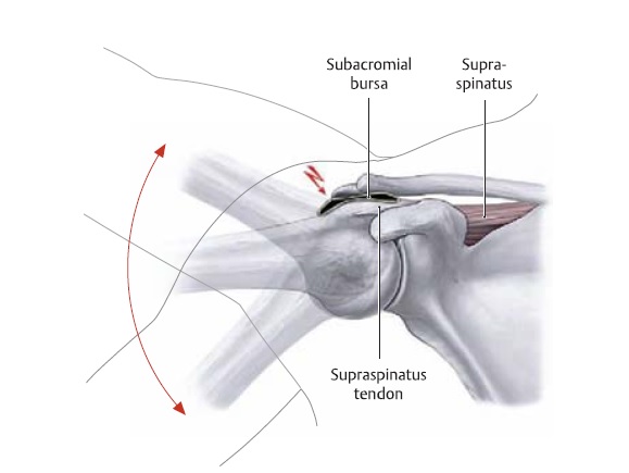 painful arc in shoulder joint