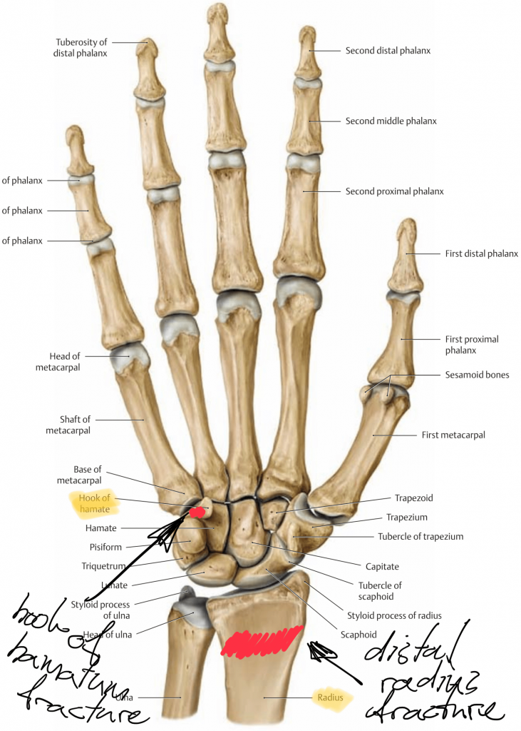 location of hook of hamatum and distal radius fracture