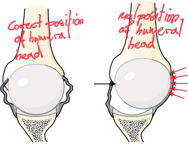 translation of humeral head in shoulder joint