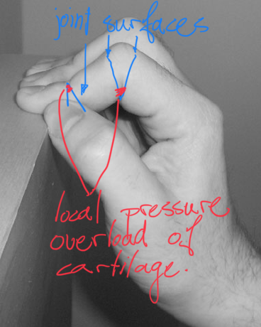 pressure points of cartilage while crimping 